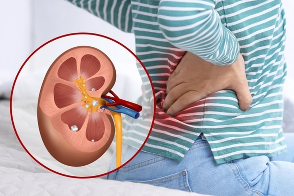 10 Gejala Awal Gagal Ginjal yang Perlu Diperhatikan